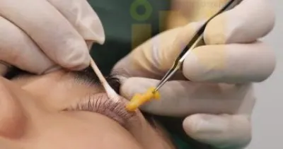 눈두덩이지방제거 수술중