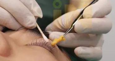 제거되는 지방