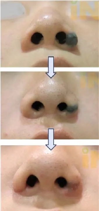 곽시후12차전후2.jpg